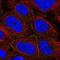 ARVCF Delta Catenin Family Member antibody, NBP2-58220, Novus Biologicals, Immunocytochemistry image 