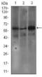 FcERI antibody, GTX60720, GeneTex, Western Blot image 