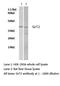 Sirtuin 2 antibody, LS-C175836, Lifespan Biosciences, Western Blot image 