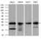 Protein-L-Isoaspartate (D-Aspartate) O-Methyltransferase antibody, LS-C795191, Lifespan Biosciences, Western Blot image 