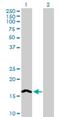 Ninjurin 2 antibody, H00004815-B01P, Novus Biologicals, Western Blot image 