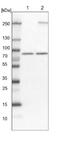 ATP Binding Cassette Subfamily F Member 3 antibody, NBP1-84781, Novus Biologicals, Western Blot image 