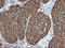 VHL Binding Protein 1 antibody, LS-C174044, Lifespan Biosciences, Immunohistochemistry frozen image 