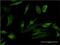 Purinergic Receptor P2Y1 antibody, H00005028-M01, Novus Biologicals, Immunocytochemistry image 