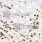 Small Ubiquitin Like Modifier 4 antibody, A3100, ABclonal Technology, Immunohistochemistry paraffin image 