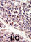 Neurotrophic Receptor Tyrosine Kinase 3 antibody, abx033618, Abbexa, Western Blot image 