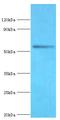 Bromodomain Containing 9 antibody, MBS1499535, MyBioSource, Western Blot image 