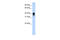 TIA1 Cytotoxic Granule Associated RNA Binding Protein antibody, 29-459, ProSci, Western Blot image 