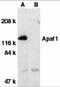 Apoptotic Peptidase Activating Factor 1 antibody, 2015, ProSci, Western Blot image 