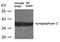 Synaptoporin antibody, 79-661, ProSci, Western Blot image 