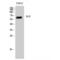 Insulin Like Growth Factor Binding Protein Acid Labile Subunit antibody, LS-C381997, Lifespan Biosciences, Western Blot image 