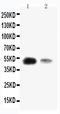 Krueppel-like factor 8 antibody, PA1890, Boster Biological Technology, Western Blot image 