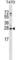 Zinc Finger Matrin-Type 2 antibody, abx027023, Abbexa, Western Blot image 