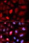 PDZ And LIM Domain 5 antibody, 19-814, ProSci, Immunofluorescence image 