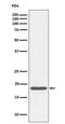 Caveolin 3 antibody, M00990-2, Boster Biological Technology, Western Blot image 