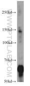 Neurofilament Light antibody, 12998-1-AP, Proteintech Group, Western Blot image 