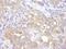 Valosin Containing Protein Interacting Protein 1 antibody, NBP1-49939, Novus Biologicals, Immunohistochemistry paraffin image 