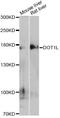 DOT1 Like Histone Lysine Methyltransferase antibody, LS-C747446, Lifespan Biosciences, Western Blot image 