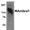 Autophagy And Beclin 1 Regulator 1 antibody, AHP1889, Bio-Rad (formerly AbD Serotec) , Immunofluorescence image 