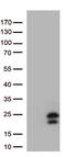 Interferon Lambda 1 antibody, M07060, Boster Biological Technology, Western Blot image 