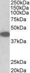 Vasoactive Intestinal Peptide Receptor 1 antibody, 42-856, ProSci, Western Blot image 