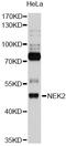 NIMA Related Kinase 2 antibody, LS-C748387, Lifespan Biosciences, Western Blot image 