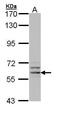 Glucose-6-Phosphate Dehydrogenase antibody, PA5-29662, Invitrogen Antibodies, Western Blot image 