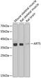 ADP-Ribosyltransferase 5 antibody, 22-738, ProSci, Western Blot image 