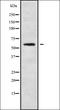 HNF1 Homeobox B antibody, orb336241, Biorbyt, Western Blot image 