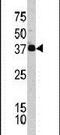 Complement Factor H Related 1 antibody, PA5-13565, Invitrogen Antibodies, Western Blot image 