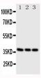 CD1a Molecule antibody, PA1875, Boster Biological Technology, Western Blot image 