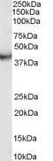 Vacuolar protein sorting-associated protein 37C antibody, LS-B4930, Lifespan Biosciences, Western Blot image 