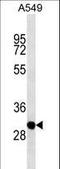 THAP Domain Containing 11 antibody, LS-C161844, Lifespan Biosciences, Western Blot image 