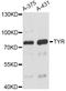 Tyrosinase antibody, A11988, ABclonal Technology, Western Blot image 