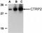 C1q And TNF Related 2 antibody, NBP1-76671, Novus Biologicals, Western Blot image 