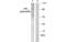 Progesterone Receptor antibody, MBS839228, MyBioSource, Western Blot image 