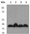 Ubiquitin Conjugating Enzyme E2 I antibody, ab75854, Abcam, Western Blot image 