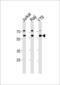 Acetylcholinesterase antibody, LS-C97167, Lifespan Biosciences, Western Blot image 