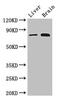 TANK Binding Kinase 1 antibody, CSB-PA023232LA01HU, Cusabio, Western Blot image 