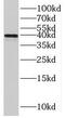 Tropomyosin 3 antibody, FNab08891, FineTest, Western Blot image 