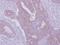 Hepatocyte Growth Factor-Regulated Tyrosine Kinase Substrate antibody, GTX101718, GeneTex, Immunohistochemistry paraffin image 