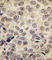 DNA Methyltransferase 3 Beta antibody, abx025686, Abbexa, Western Blot image 