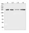 DCC Netrin 1 Receptor antibody, A00560, Boster Biological Technology, Western Blot image 