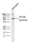 Peroxisome Proliferator Activated Receptor Gamma antibody, GTX03364, GeneTex, Western Blot image 