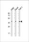 Spi-1 Proto-Oncogene antibody, M01116-1, Boster Biological Technology, Western Blot image 