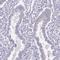 Adaptor Related Protein Complex 1 Subunit Sigma 2 antibody, HPA049894, Atlas Antibodies, Immunohistochemistry paraffin image 