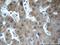 Fibrinogen Gamma Chain antibody, 15841-1-AP, Proteintech Group, Immunohistochemistry paraffin image 