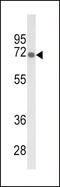 GLGB antibody, 63-981, ProSci, Western Blot image 