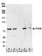 6-phosphofructokinase, muscle type antibody, A304-255A, Bethyl Labs, Western Blot image 