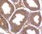 ADAM Metallopeptidase Domain 7 antibody, NBP2-75396, Novus Biologicals, Immunohistochemistry paraffin image 